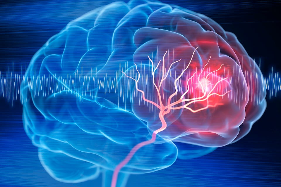 Exploring the Fascinating World of Neurology
